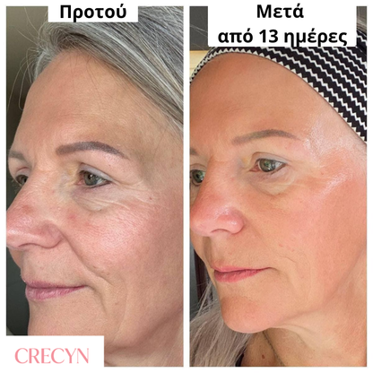 Μάσκα νύχτας με κορεατικό κολλαγόνο